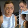 избитый военнослужащий
